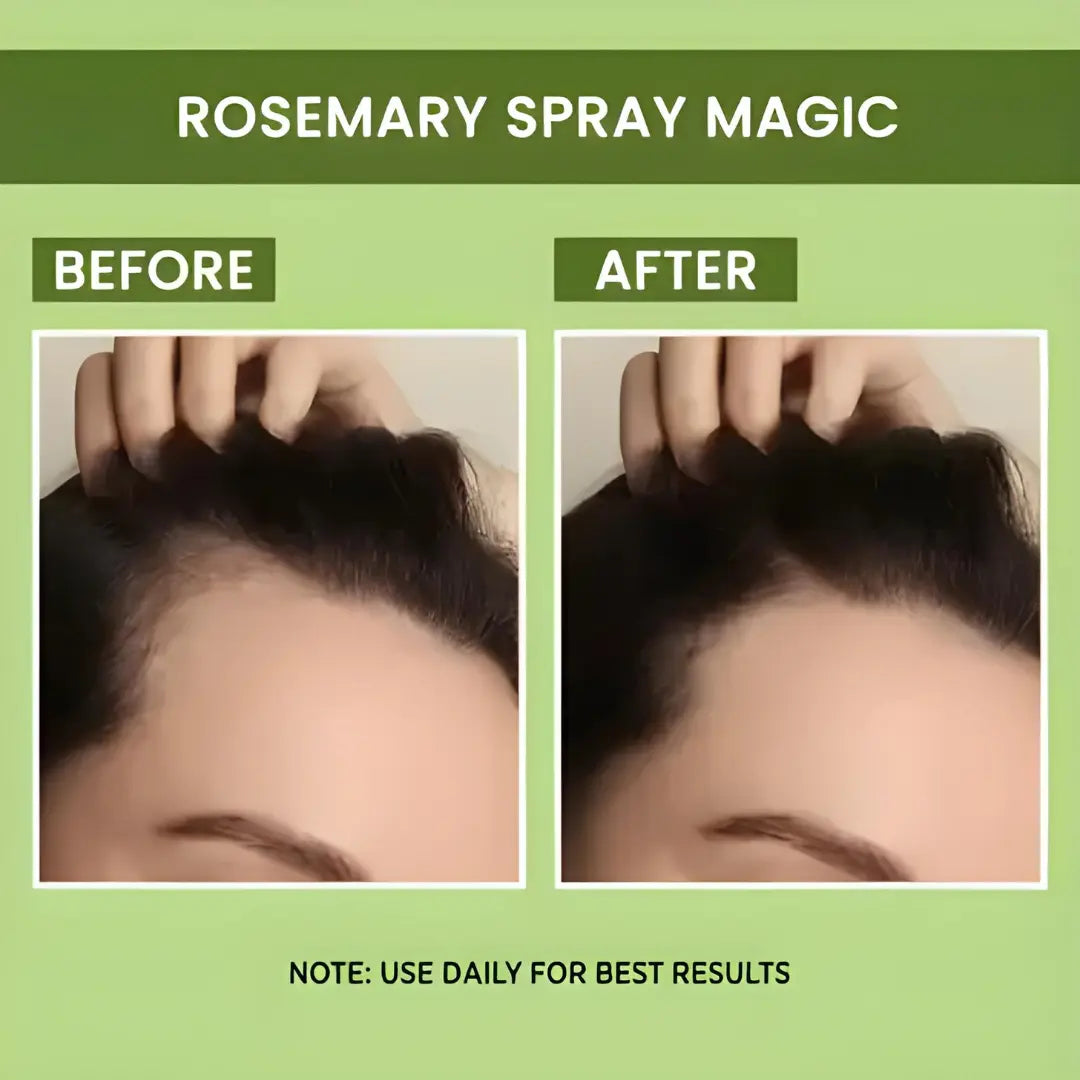 Rosemary Water Spray | For Hair Regrowth (Buy 1 Get 1 Free😍)