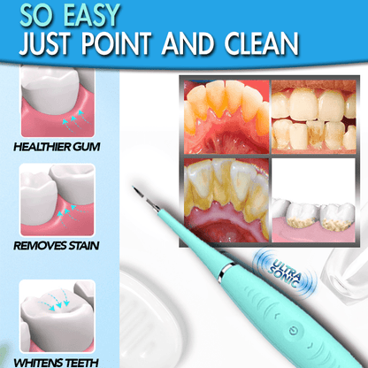 TOOTH STAIN ERASER